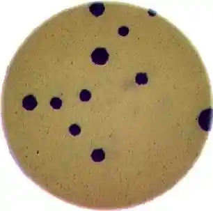 Image of bacteria colonies in a petri dish