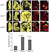 Angpt1 is critical in cardiac development.