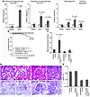 Angpt1 protects the glomerular vasculature in diabetic nephropathy.