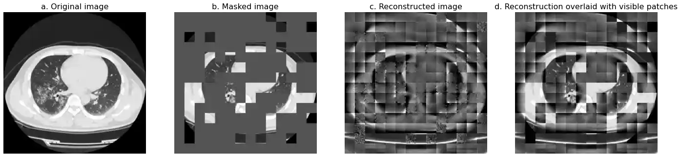 C1000_pretrain_model