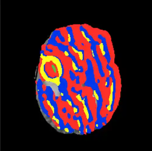 Results of initial segmentation