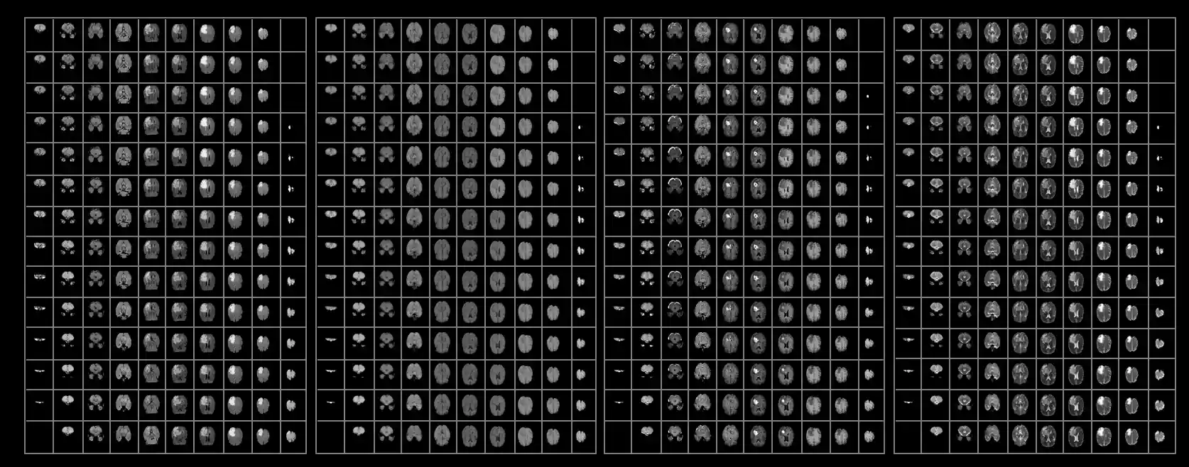 All images produced from a single patient brain scan.