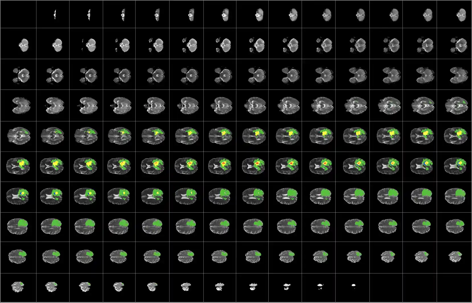 Results of the complete segmentation of a single brain