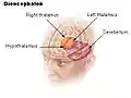 Illu diencephalon.jpg