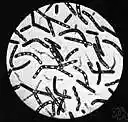 Bacteroidaceae - family of bacteria living usually in the alimentary canal or on mucous surfaces of warm-blooded animals