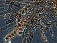 Microscopic view of numerous translucent or transparent elongated sac-like structures each containing eight spheres lined up in a row