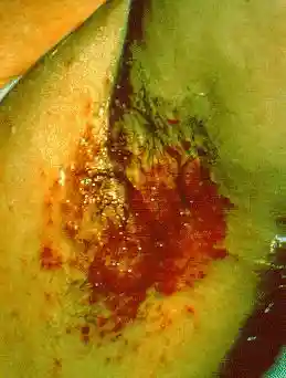 Axillary intertrigo.png