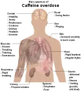 Torso of a young man with overlaid text of main side-effects of caffeine overdose.