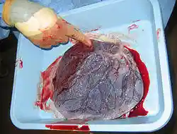 Human placenta baby side.jpg