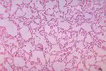 Bacteroides biacutis