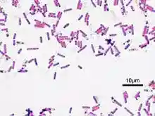 Bacillus subtilis Gram.jpg