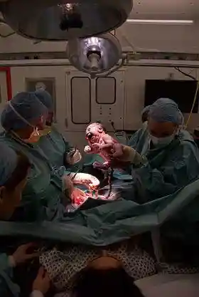 Cesarian the moment of birth3.jpg
