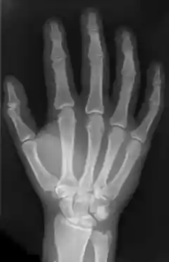 Handskelett.png
