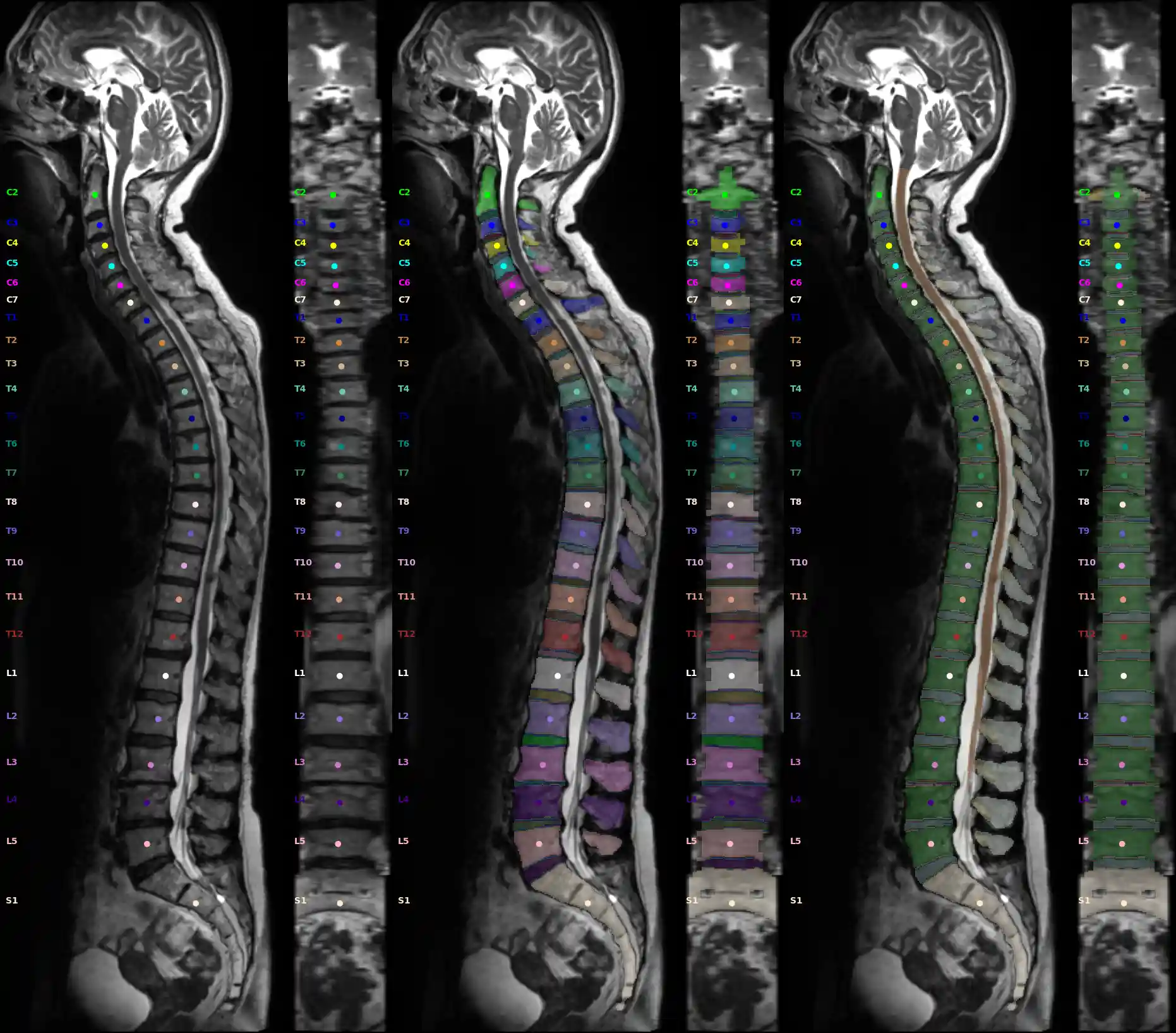 Snapshot2D Spine example