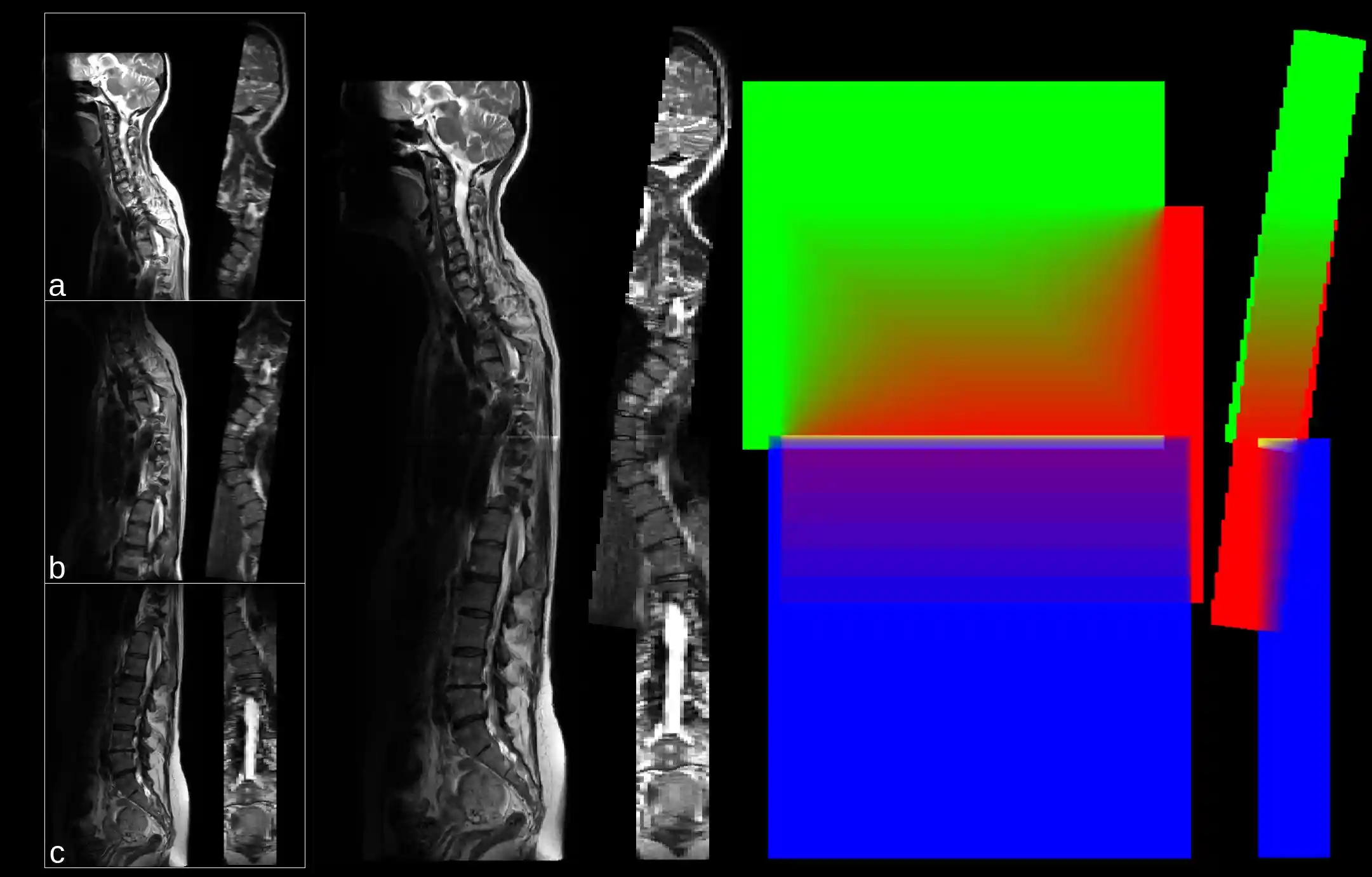 Example of a stitching