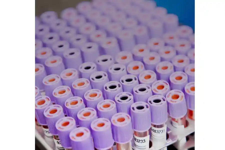 Healthcare & Biomedicine CFD Simulation