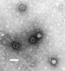 TEM micrograph of poliovirus virions. Scale bar, 50 nm.
