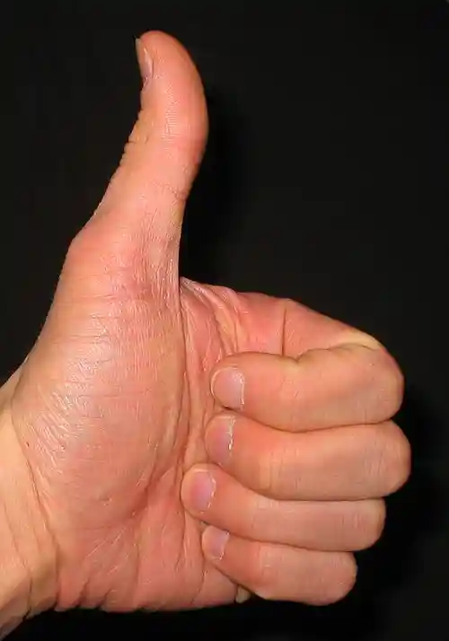 File:Thumbs up.jpg