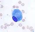 Osteoblast (Wright Giemsa stain, 100x)