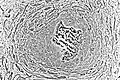Light micrograph of undecalcified tissue displaying osteoblasts actively synthesizing rudimentary bone tissue (center)