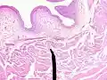 Layers of the bladder wall and cross-section of the detrusor muscle