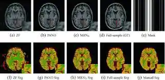 Joint CS‑MRI thumbnail